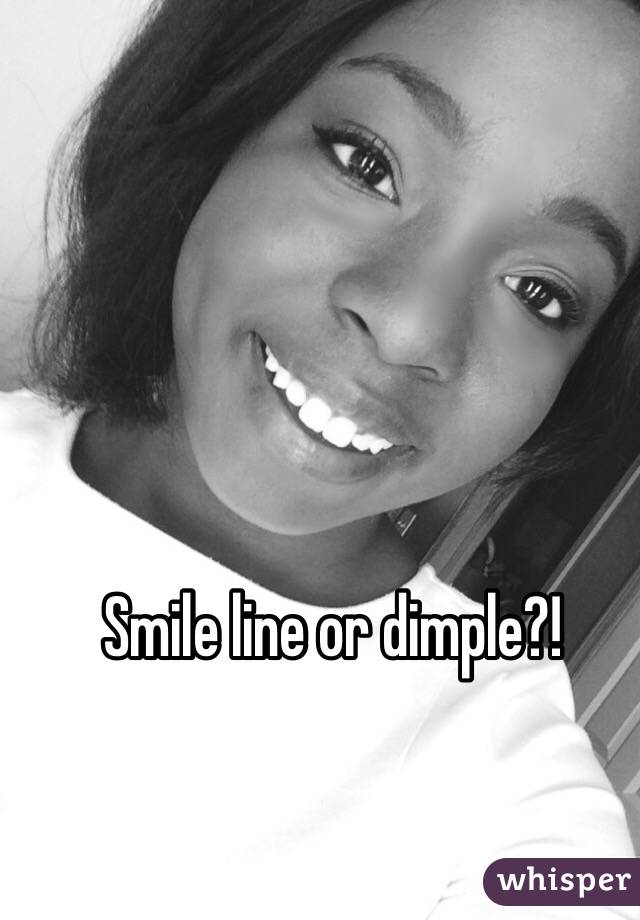 smile-lines-or-dimples